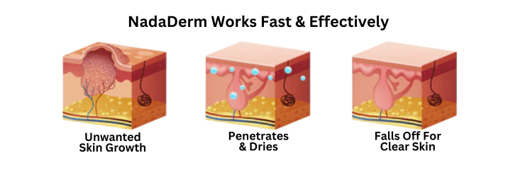NadaDerm Elite + 1 FREE - nadaderm
