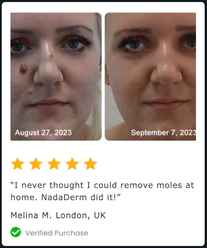 2x NadaDerm Elite BOGO - nadaderm