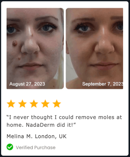 2x NadaDerm Elite BOGO - nadaderm